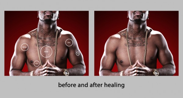 Before and After Healing