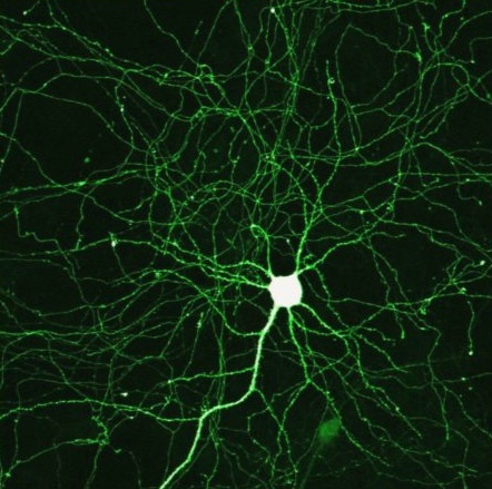 Synapse: MikeBlogs via photopin cc origin_Synapse: MikeBlogs via photopin cc3101400087