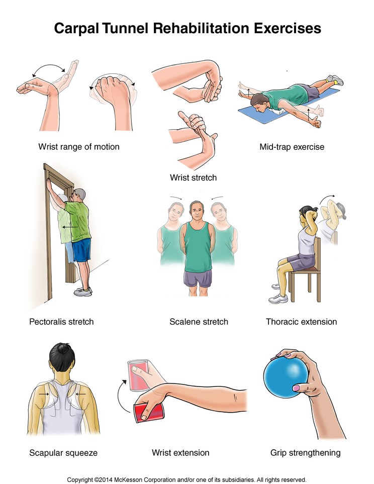 Preventing and Treating Carpal Tunnel Syndrome